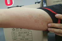 [휴웰수 체험 후기]  열꽃 체험후기